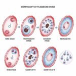 Diabetes—Types, Symptoms & Management
