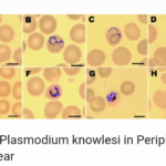 Morphology of Plasmodium Ovale