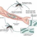 Historical Background of Filariasis