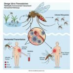 Signs and Symptoms of Dengue Fever