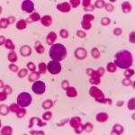 Magnitude of the Dengue Problem: Global Overview