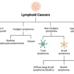 Non-Hodgkin Lymphoma Cancer