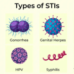 Essential Facts About Reproductive Tract Infections (RTIs)