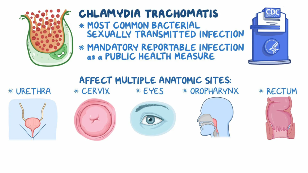 Chlamydia