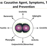 Chlamydia Trachomatis : Symptoms, Diagnosis, Treatment & Prevention