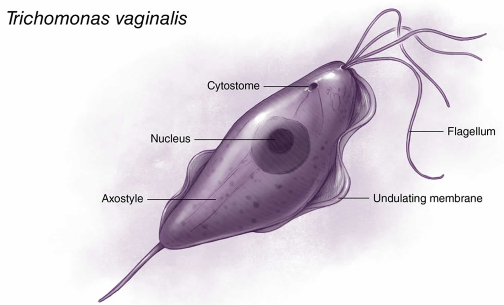 Trichomoniasis