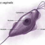 Trichomoniasis: Symptoms, Diagnosis, Treatment and Prevention