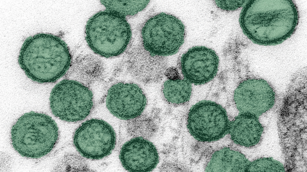 Transmission electron micrograph of Sin Nombre virus particles showing spherical virions