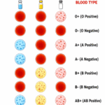 Bombay Blood Group & Artificial Blood: 5 Critical Facts