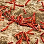 Morphology of Mycobacterium leprae