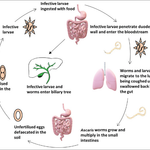 Epidemiological factors of ascariasis